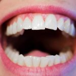 5 tips-uri pentru dinti de un alb stralucitor